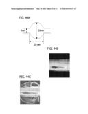 DIRECT ECHO PARTICLE IMAGE VELOCIMETRY FLOW VECTOR MAPPING ON ULTRASOUND     DICOM IMAGES diagram and image