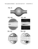 DIRECT ECHO PARTICLE IMAGE VELOCIMETRY FLOW VECTOR MAPPING ON ULTRASOUND     DICOM IMAGES diagram and image