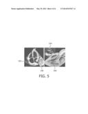 INTRA-OPERATIVE IMAGE CORRECTION FOR IMAGE-GUIDED INTERVENTIONS diagram and image