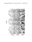 COMPOSITIONS AND METHODS FOR FORMATION OF BONE TISSUE diagram and image