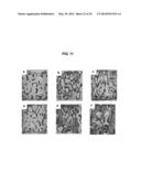 COMPOSITIONS AND METHODS FOR FORMATION OF BONE TISSUE diagram and image