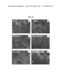 COMPOSITIONS AND METHODS FOR FORMATION OF BONE TISSUE diagram and image