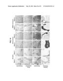 COMPOSITIONS AND METHODS FOR FORMATION OF BONE TISSUE diagram and image