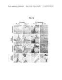 COMPOSITIONS AND METHODS FOR FORMATION OF BONE TISSUE diagram and image