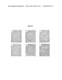 COMPOSITIONS AND METHODS FOR FORMATION OF BONE TISSUE diagram and image