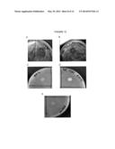 ANTICARIES COMPOSITIONS AND PROBIOTICS/PREBIOTICS diagram and image