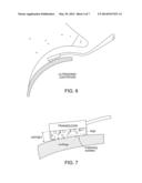 METHODS AND DEVICES SUITABLE FOR IMPROVED REATTACHMENT OF DETACHED     CARTILAGE TO SUBCHONDRAL BONE diagram and image