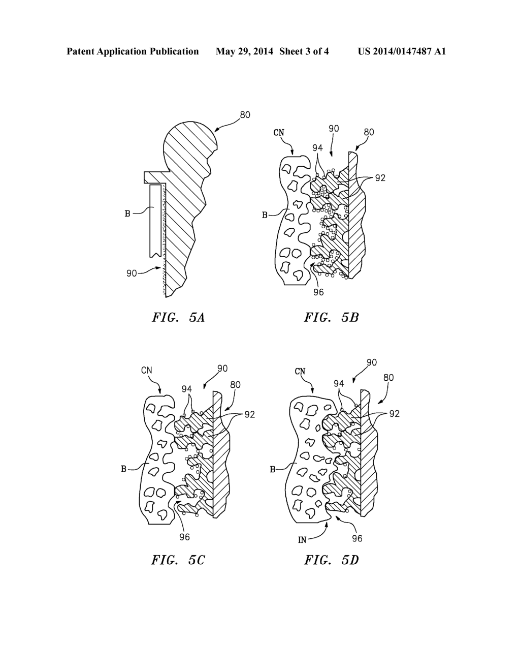 Methods of Using Water-Soluble Inorganic Compounds for Implants - diagram, schematic, and image 04