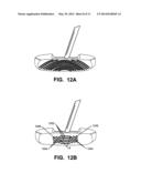 Golf Club Heads diagram and image