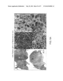 NUCLEIC ACIDS ENCODING BIOLOGICALLY ACTIVE POLYPEPTIDES DERIVED FROM A     NOVEL EARLY STAGE PREGNANCY FACTOR DESIGNATED MATERNIN (MA) diagram and image