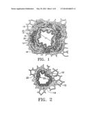 METHODS FOR TREATING AIRWAYS diagram and image