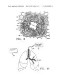 METHODS FOR TREATING AIRWAYS diagram and image