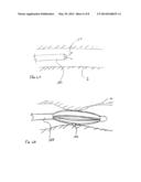 METHODS FOR TREATING AIRWAYS diagram and image