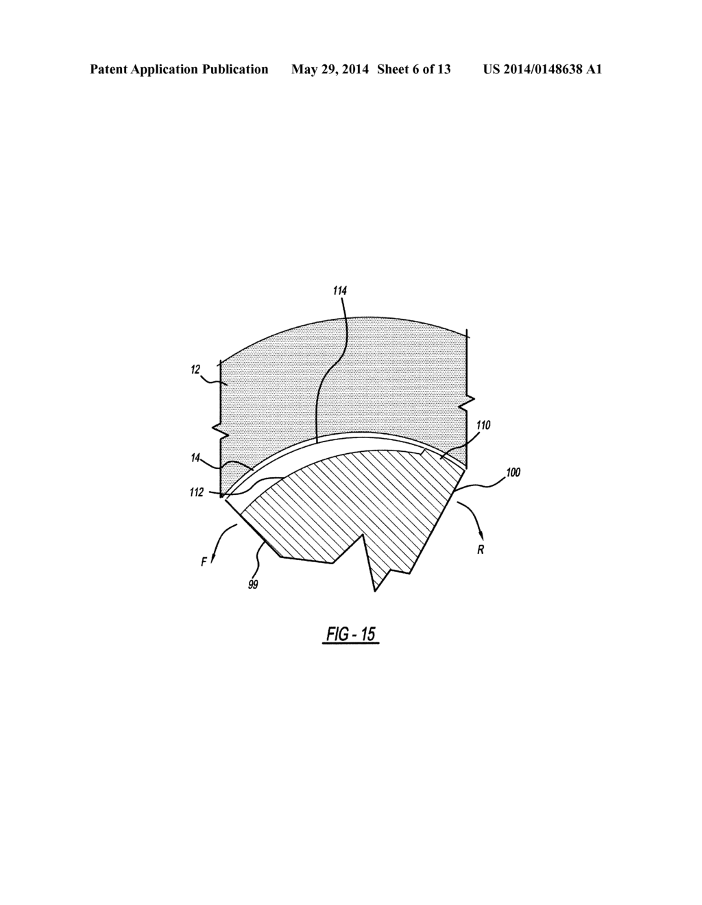 INTRAVASCULAR VENTRICULAR ASSIST DEVICE - diagram, schematic, and image 07