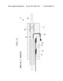 ENDOSCOPE diagram and image