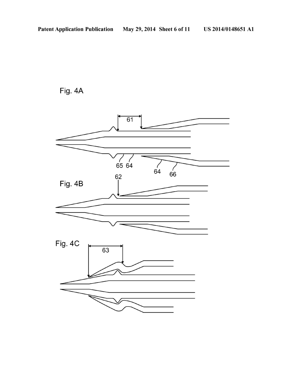 NOVEL BUMPED DILATOR TIP - diagram, schematic, and image 07