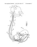 USE OF THORACIC AND EXTRA-THORACIC IMPEDANCE FOR DIAGNOSTIC MONITORING diagram and image