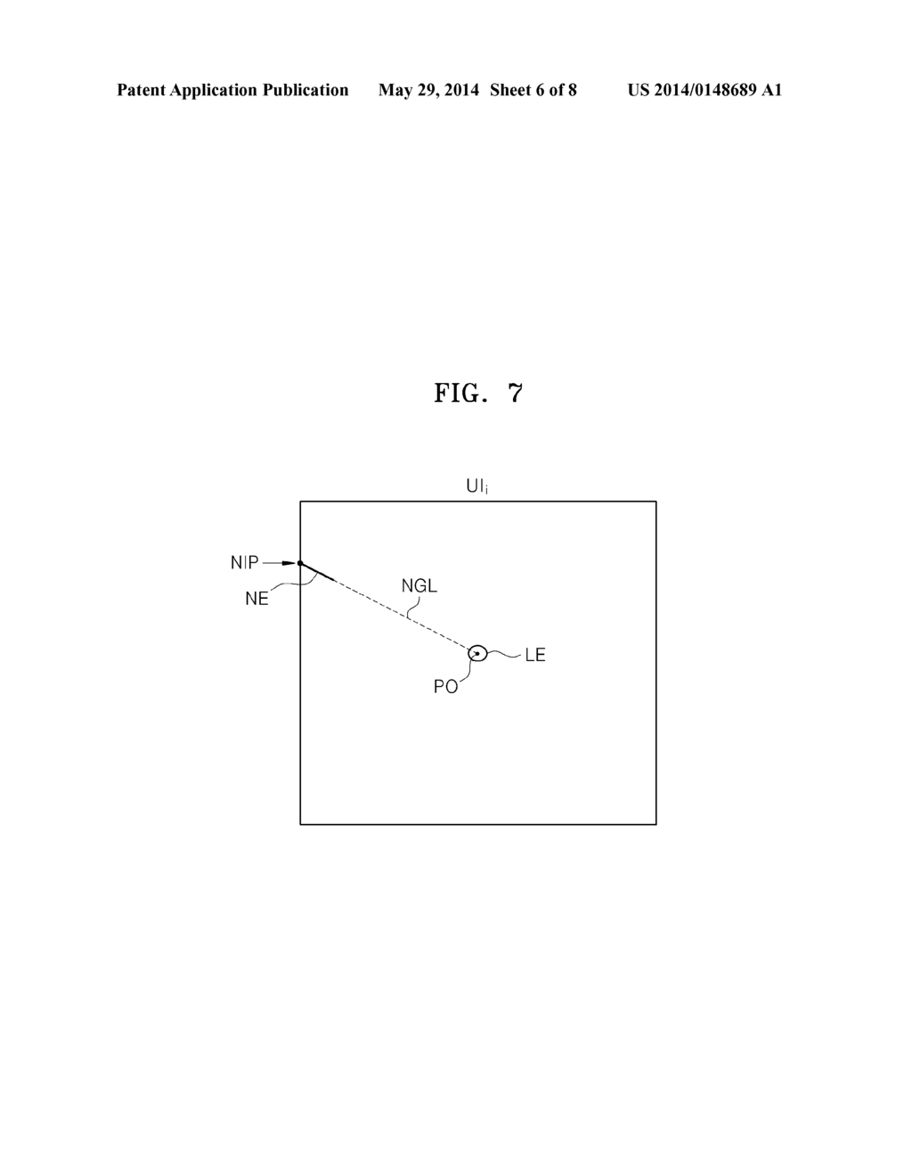 ULTRASOUND SYSTEM AND METHOD FOR PROVIDING GUIDELINE OF NEEDLE - diagram, schematic, and image 07