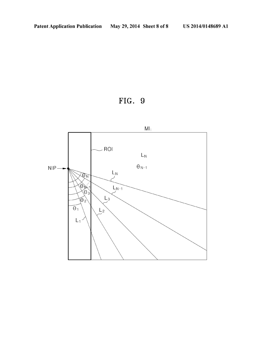 ULTRASOUND SYSTEM AND METHOD FOR PROVIDING GUIDELINE OF NEEDLE - diagram, schematic, and image 09