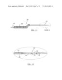 Method and Apparatus for Surgical Navigation diagram and image