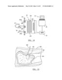 Method and Apparatus for Surgical Navigation diagram and image