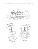 Method and Apparatus for Surgical Navigation diagram and image