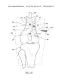 Method and Apparatus for Surgical Navigation diagram and image