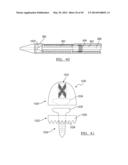 Method and Apparatus for Surgical Navigation diagram and image