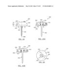 Method and Apparatus for Surgical Navigation diagram and image