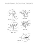 Method and Apparatus for Surgical Navigation diagram and image