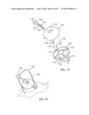 Method and Apparatus for Surgical Navigation diagram and image