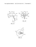 Method and Apparatus for Surgical Navigation diagram and image