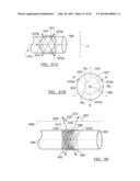 Method and Apparatus for Surgical Navigation diagram and image