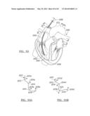 Method and Apparatus for Surgical Navigation diagram and image