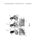 METHOD AND SYSTEM FOR PATIENT-SPECIFIC MODELING OF BLOOD FLOW diagram and image