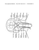 METHOD AND SYSTEM FOR PATIENT-SPECIFIC MODELING OF BLOOD FLOW diagram and image