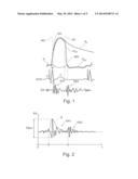 IMPLANTABLE CARDIAC PROSTHESIS WITH ACTIVE DETECTION OF ATRIAL MECHANICAL     ACTIVITY diagram and image