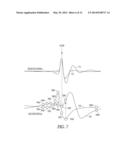 METHOD AND SYSTEM FOR ARRHYTHMIA DISCRIMINATION diagram and image