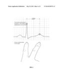 Multi-touch approach for ECG measurement diagram and image