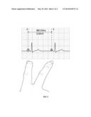 Multi-touch approach for ECG measurement diagram and image