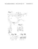 METHODS FOR PERFORMING BARIATRIC SURGERY USING GASTRIC SIZING SYSTEMS AND     INSTRUMENTS diagram and image