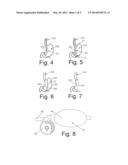 METHODS FOR PERFORMING BARIATRIC SURGERY USING GASTRIC SIZING SYSTEMS AND     INSTRUMENTS diagram and image