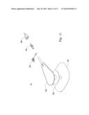 WOUND DRAINAGE THERAPY SYSTEM diagram and image