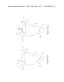 Methods and Apparatus for Applying Adhesives In Patterns To An Advancing     Substrate diagram and image