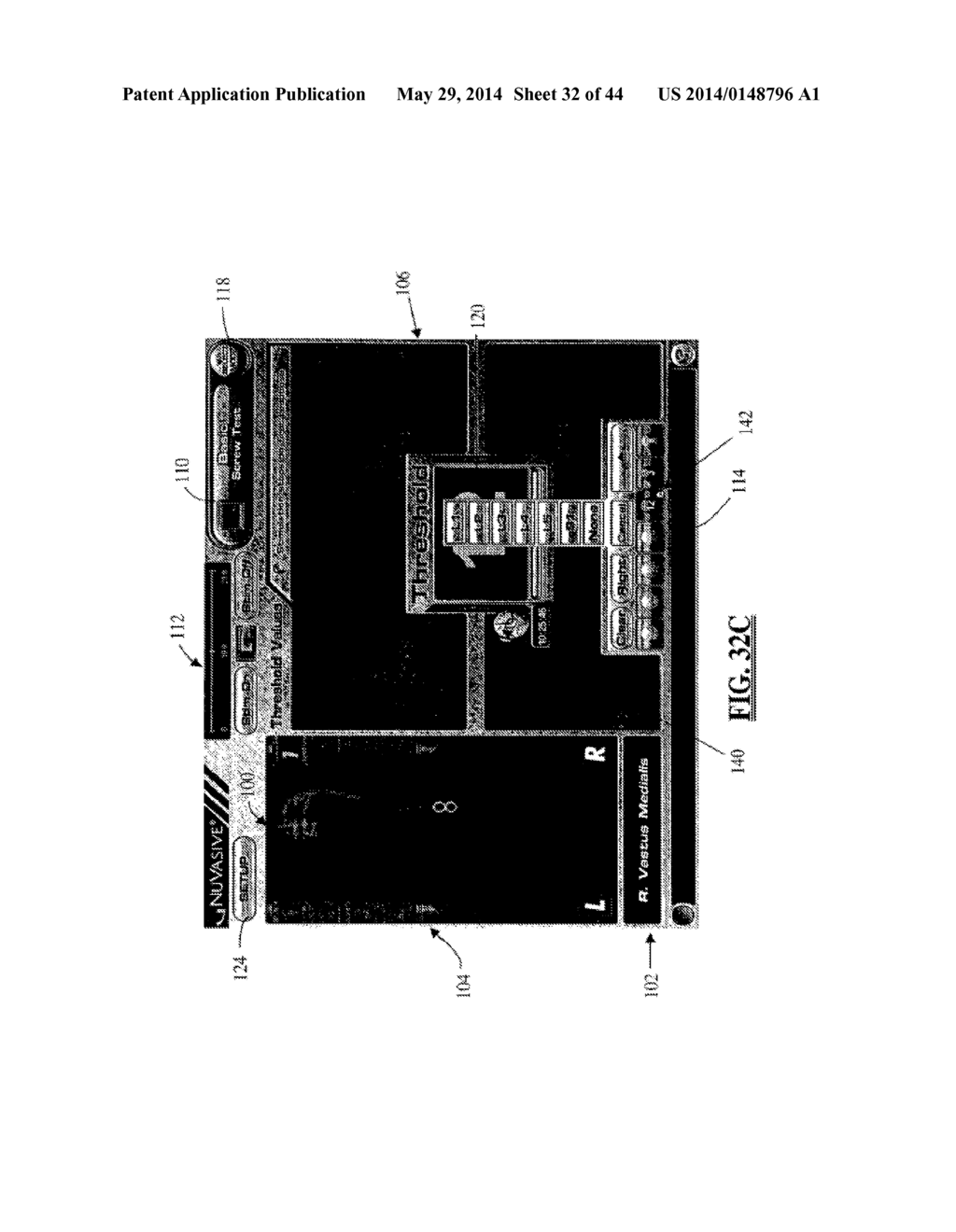 System and Methods for Assessing the Neuromuscular Pathway Prior to Nerve     Testing - diagram, schematic, and image 33