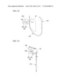 TISSUE LIGATING DEVICE diagram and image