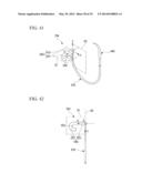 TISSUE LIGATING DEVICE diagram and image