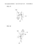 TISSUE LIGATING DEVICE diagram and image