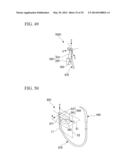 TISSUE LIGATING DEVICE diagram and image