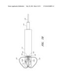 SUTURING DEVICES AND METHODS FOR SUTURING AN ANATOMIC VALVE diagram and image